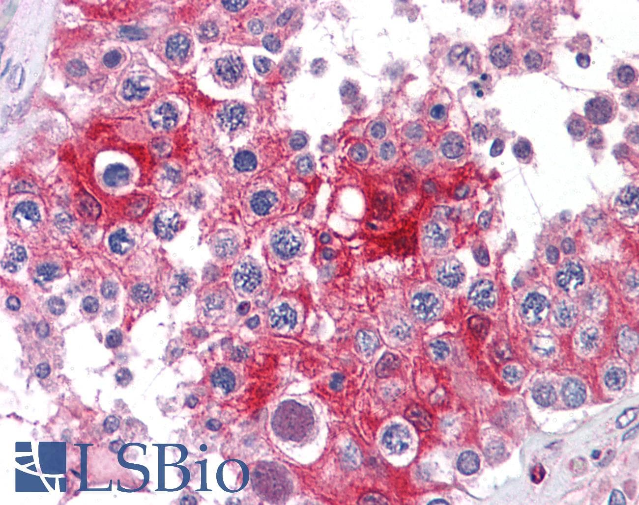 IHC-plus™ Monoclonal Mouse anti-Human LDHA / LDH1 Antibody (IHC)