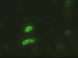 EPCAM Antibody (clone OTI4G10)