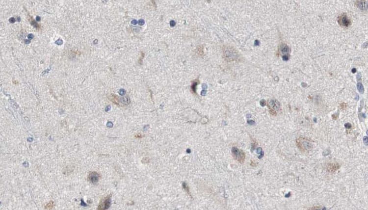 SH3GL3 Antibody
