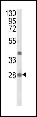 EIF4E2 / IF4e Antibody