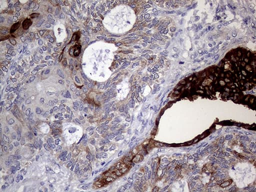 Monoclonal Mouse anti-Human AGR2 Antibody (clone OTI2B10, aa21-175, IHC, WB)