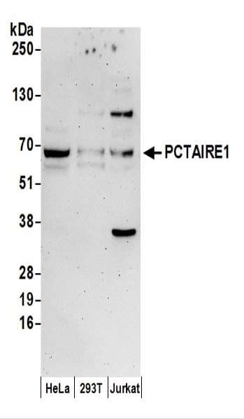 Polyclonal Rabbit anti-Human CDK16 / PCTAIRE Antibody (aa25-75, WB)