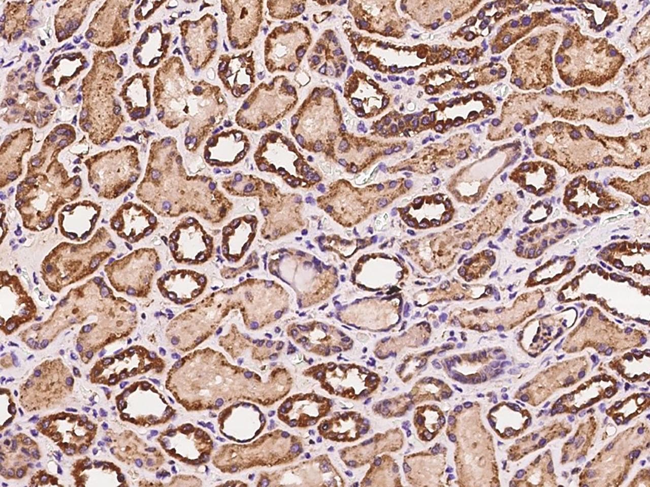 STC1 / Stanniocalcin Antibody