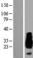 Human APRT Protein (Over-Expression Lysate Myc-DDK (Flag))