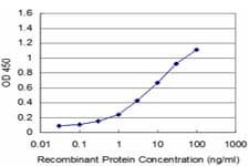 Monoclonal Mouse anti-Human Nor-1 / NR4A3 Antibody (clone 1E9, IF, WB)