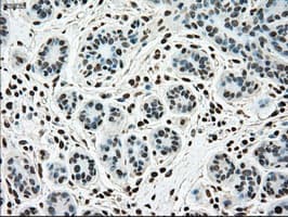 SSB / La Antibody (clone OTI2C8)