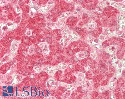 IHC-plus™ GLYCTK / Glycerate Kinase Antibody (aa144-523)