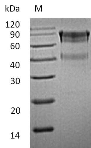 Mouse IL15RA Protein (Recombinant Fc, C-terminus)