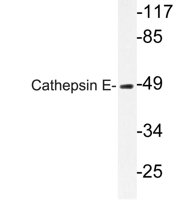 CTSE / Cathepsin E Antibody (Ile292)