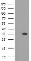 GRHPR / Glyoxylate Reductase Antibody (clone OTI10A3)