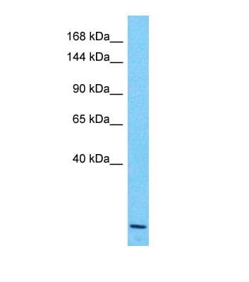 KCNH8 / ELK Antibody (aa113-162)