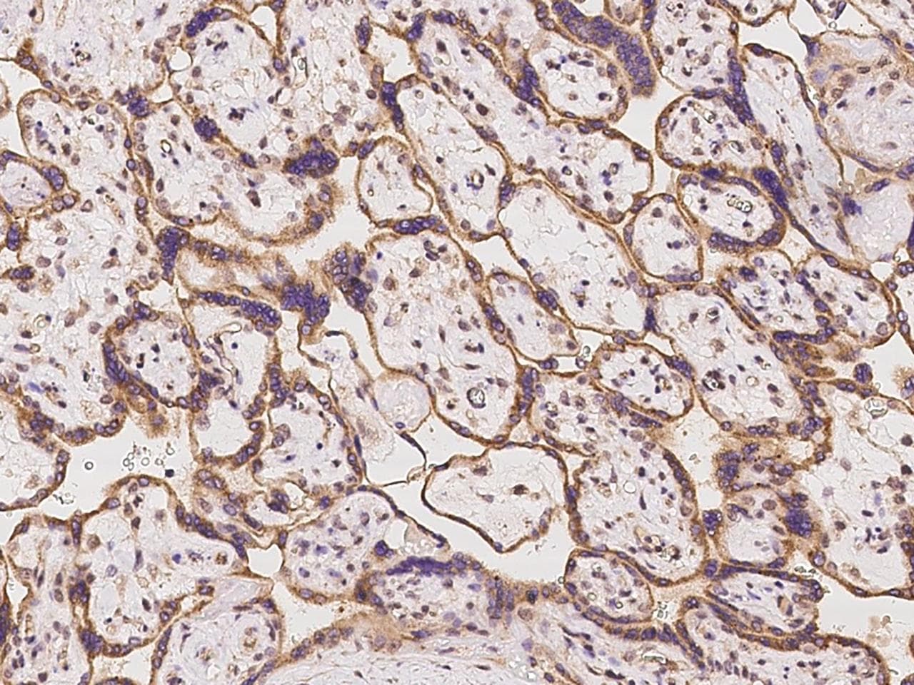 SLC35A3 Antibody