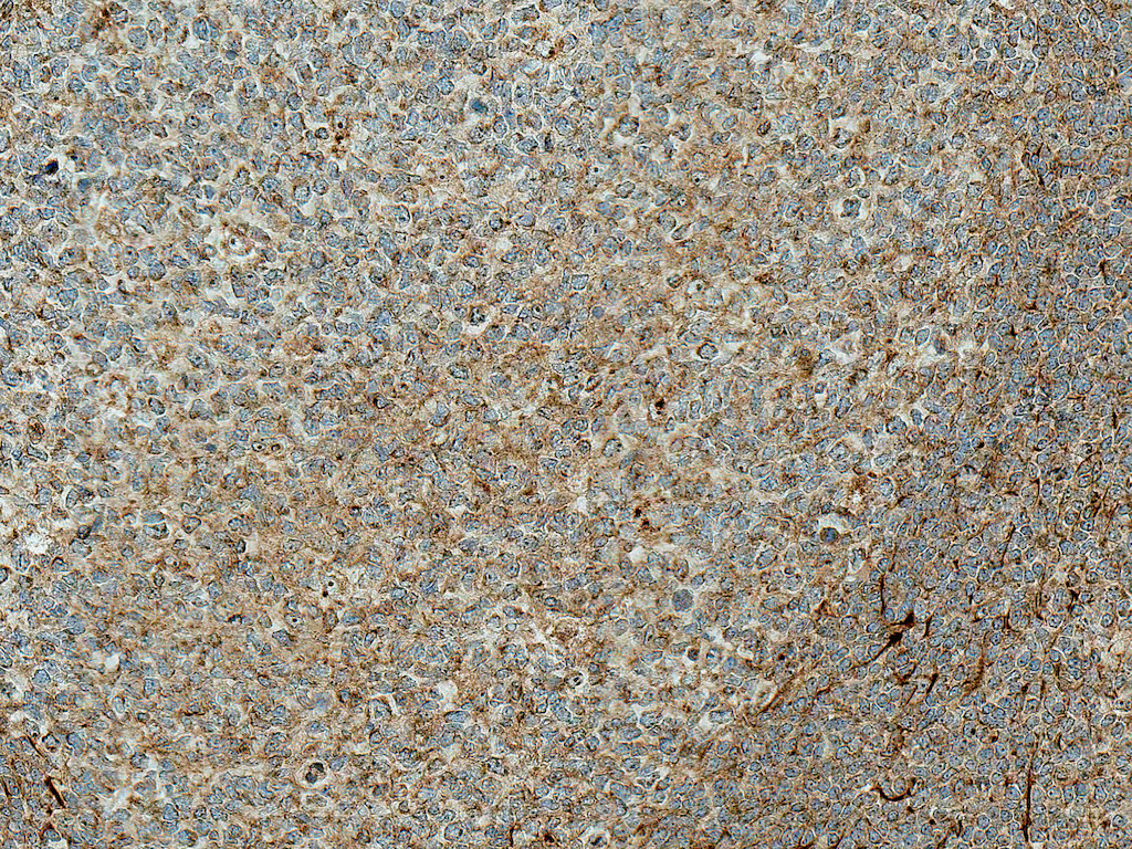 TCF7L2 / TCG4 Antibody (PerCP)