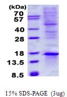 Human TIAF1 Protein (Recombinant His)
