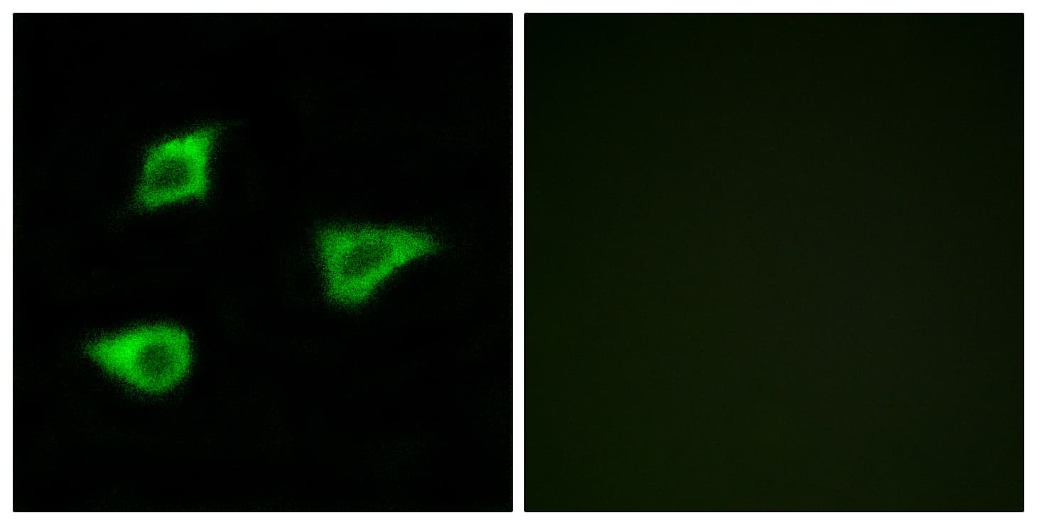 IHC-plus™ Polyclonal Rabbit anti-Human CHRM4 / M4 Antibody (aa236-285, IHC, IF)