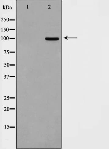 DLGAP1 Antibody