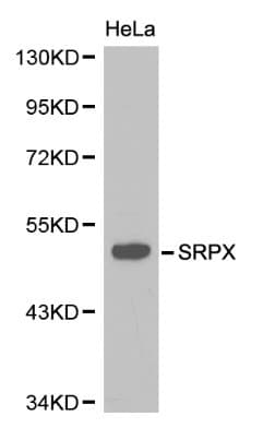 Polyclonal Rabbit anti-Human SRPX Antibody (IHC, WB)