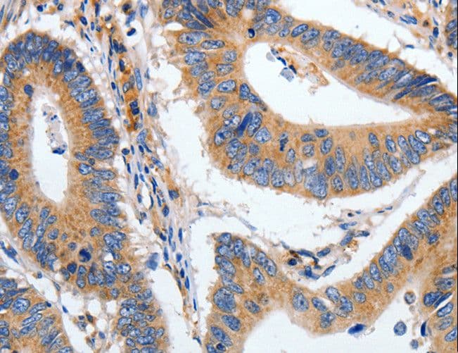 HSP70 / Heat Shock Protein 70 Antibody