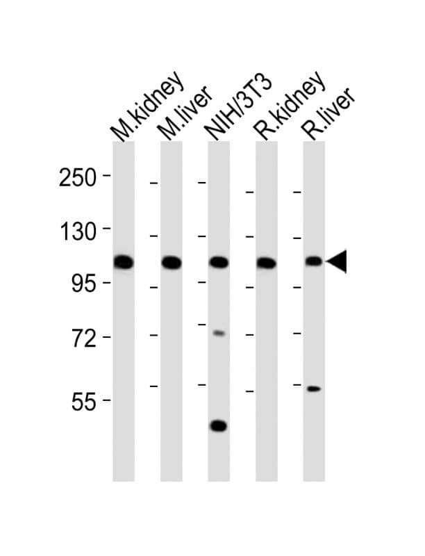 MER / MERTK Antibody (aa946-980)