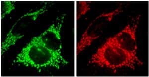Polyclonal Rabbit anti-Human FIS1 Antibody (WB)