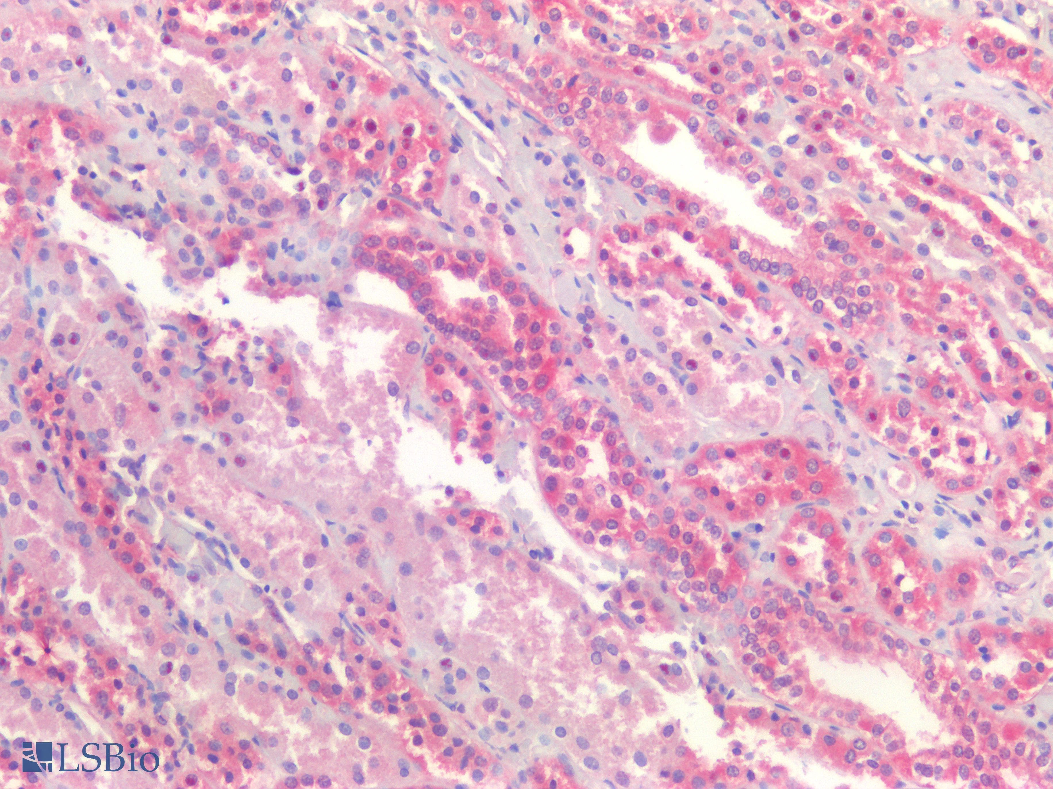 Monoclonal Mouse anti-Human KRAS Antibody (clone 2C1, Carrier-free, WB)