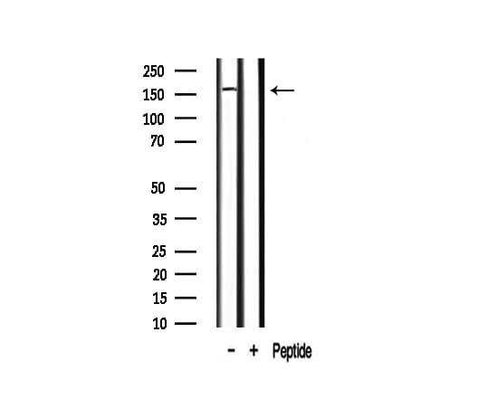 Polyclonal Rabbit anti-Human MST1R / RON Antibody (IF, WB)
