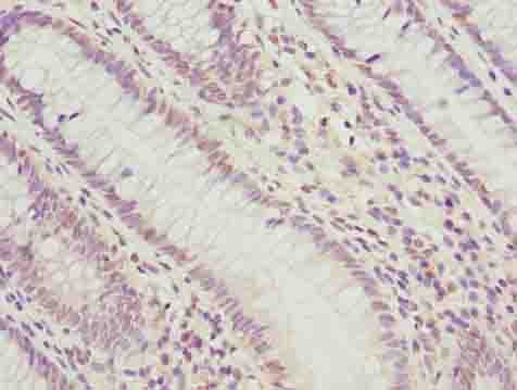 PLK1 / PLK-1 Antibody