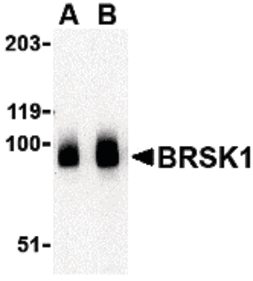 IHC-plus™ Polyclonal Rabbit anti-Human KIAA1811 / BRSK1 Antibody (IHC, IF, WB)