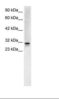 SNF8 / EAP30 Antibody (N-Terminus)
