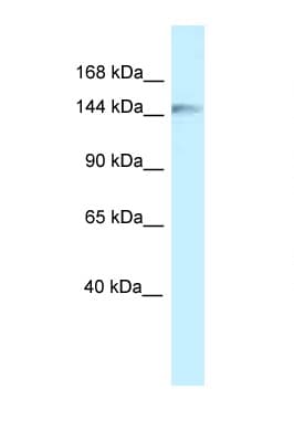 CLIP1 / CLIP-170 Antibody (aa1064-1113)