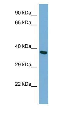 TWF2 / PTK9L Antibody (N-Terminus)