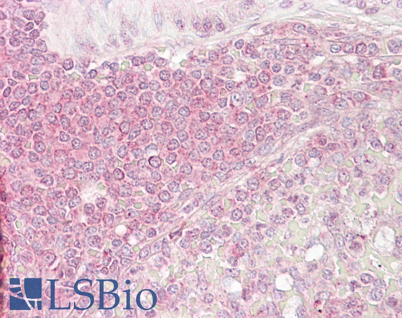 IHC-plus™ Polyclonal Rabbit anti-Human LAMP3 / CD208 Antibody (aa274-323, IHC)
