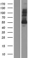 Human GSR / Glutathione Reductase Protein (Over-Expression Lysate Myc-DDK (Flag))