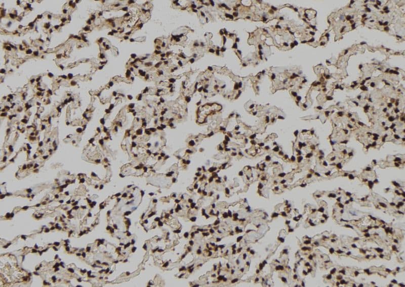 DMAP1 Antibody