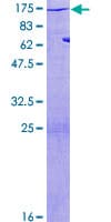 Human MYLK Protein (Recombinant GST)