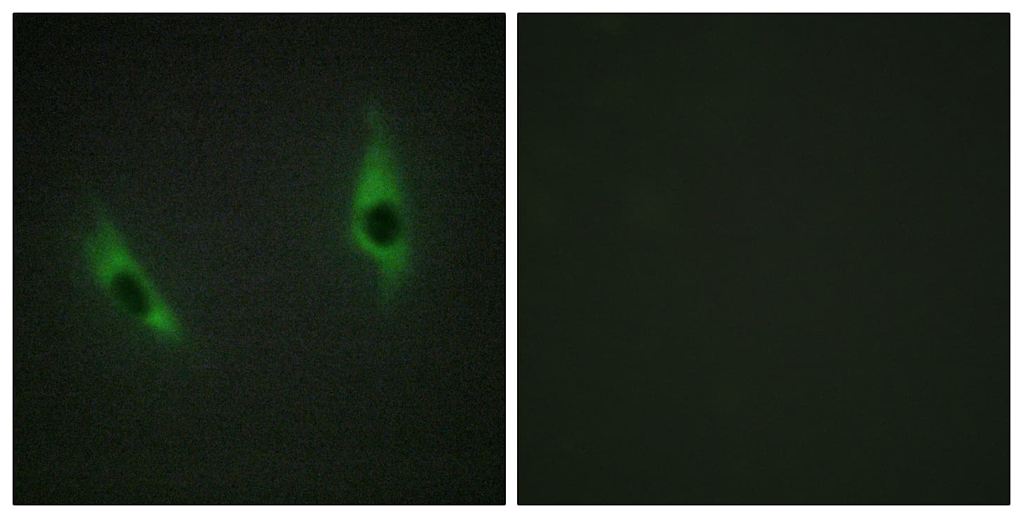 Polyclonal Rabbit anti-Human LAMB3 / Laminin Beta 3 Antibody (aa671-720, IHC, IF)