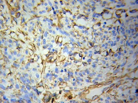 FABP4 / AP2 Antibody