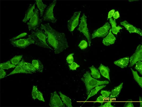 NODAL Antibody (clone 5C3)
