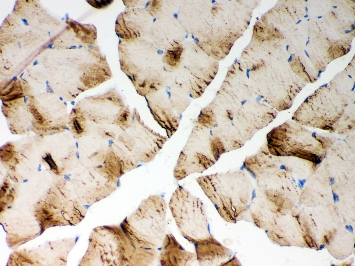 ATP2A1 / SERCA1 Antibody (aa1-32)