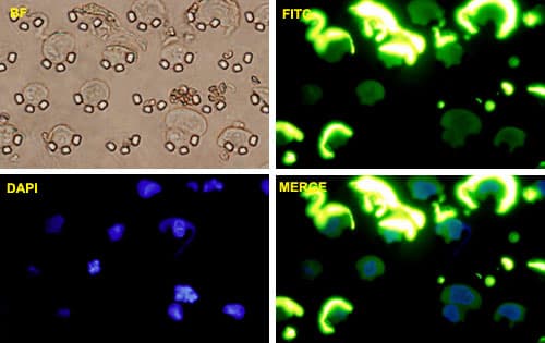 SNAI1 / SNAIL-1 Antibody (clone 2G11)