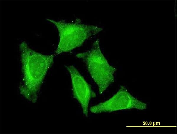 RASGEF1C Antibody (clone 3H8)