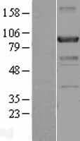 ACAP2 / Centaurin Beta 2 Protein (Over-Expression Lysate Myc-DDK (Flag))