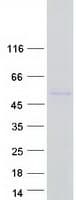 Human Delta-6 Desaturase / FADS2 Protein (Recombinant Myc-DDK (Flag))
