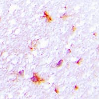 REG4 / REG-IV Antibody (Internal)