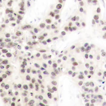 ELK1 Antibody (phospho-Thr417)