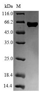 Escherichia coli fliC / Flagellin Protein (Recombinant 6His-SUMO, N-terminus)