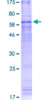 Human ADIPOR1/Adiponectin Receptor 1 Protein (Recombinant GST)