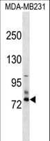 SCNN1D Antibody (aa161-189)