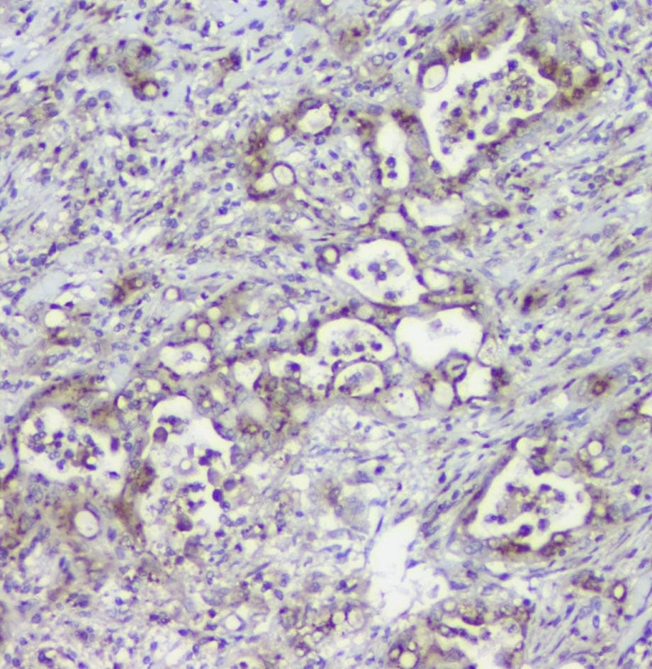 Mannose Phosphate Isomerase Antibody