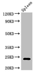 RPL19 / Ribosomal Protein L19 Antibody